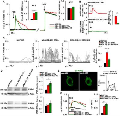 Sustained IP3-linked Ca2+ signaling promotes progression of triple negative breast cancer cells by regulating fatty acid metabolism